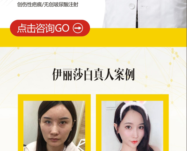 法思丽玻尿酸常德独家发售