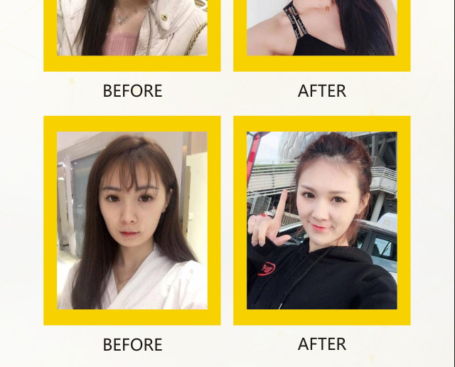 法思丽玻尿酸常德独家发售