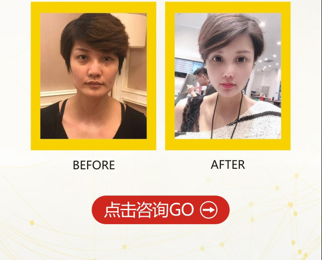 法思丽玻尿酸常德独家发售