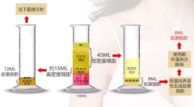 SVF胶原脂肪青春术