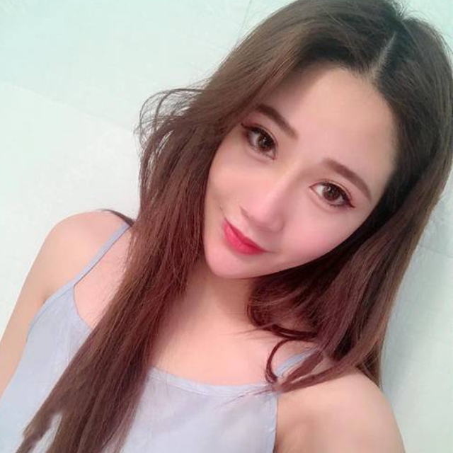 吸脂案列邱叶子